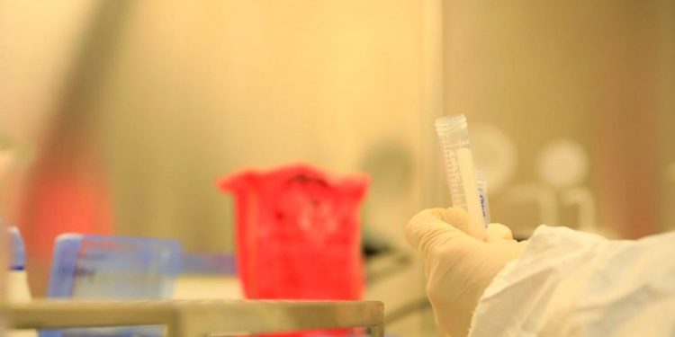 Ministerio de Salud registra mil 66 casos nuevos de coronavirus