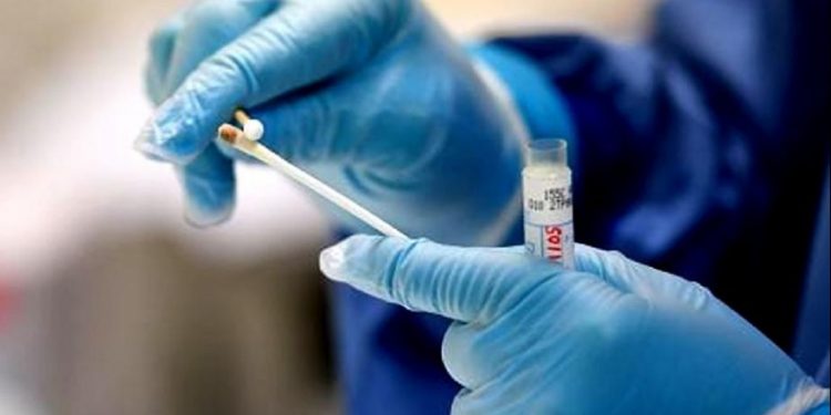 Reportan caso de un hombre reinfectado por coronavirus en Estados Unidos