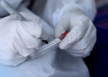 Ministerio de Salud resultado de pruebas diario coronavirus