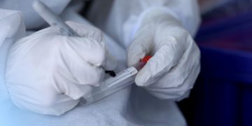 Ministerio de Salud resultado de pruebas diario coronavirus