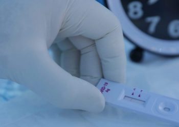 Cuatro mil 613 pruebas de coronavirus se procesaron en las últimas 24 horas