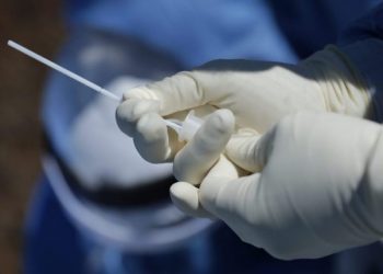 Prueba para detectar casos nuevos de coronavirus