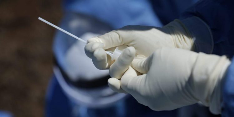 Prueba para detectar casos nuevos de coronavirus