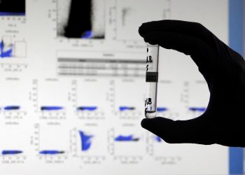 Esta técnica, más sensible que las convencionales, desvela que casi la mitad de estos pacientes poseen anticuerpos en pequeñas cantidades