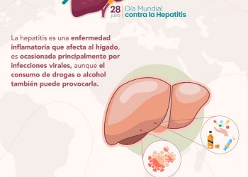 Día Mundial contra la Hepatitis: Qué es y cómo prevenir esta enfermedad