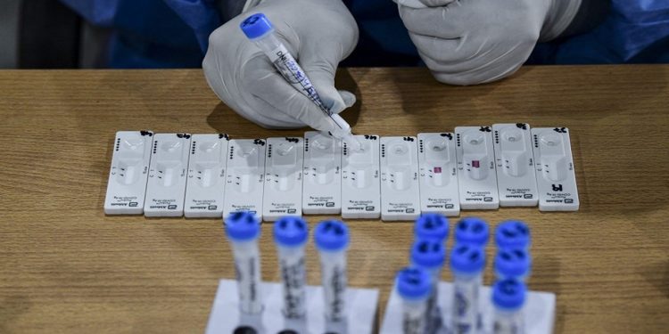 Científicos de Sudáfrica hallan una nueva variante de coronavirus muy mutante