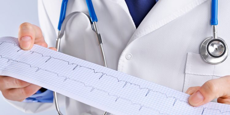 Expertos llaman a pacientes enfermos cardíacos a apegarse a tratamientos