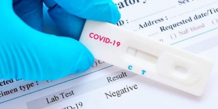 OMS y CSIC acuerdan la cesión global de la licencia de un test covid español