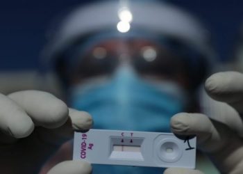 Ministerio de Salud confirma abastecimiento de un millón de pruebas para detectar COVID-19