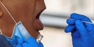Crean un test salival para detectar la endometriosis