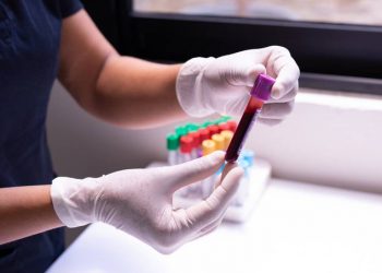 Encuentran por primera vez microplásticos en el torrente sanguíneo humano