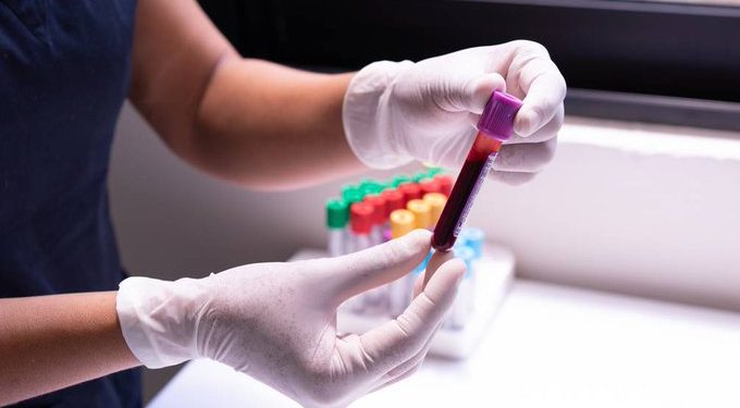 Encuentran por primera vez microplásticos en el torrente sanguíneo humano