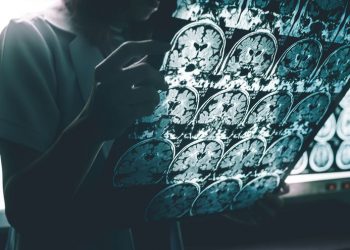 Crean sonda que emplea la luz para diagnosticar patologías cerebrales