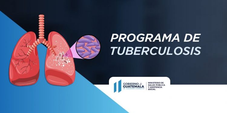 Ministerio de Salud recuerda importancia de prevenir tuberculosis