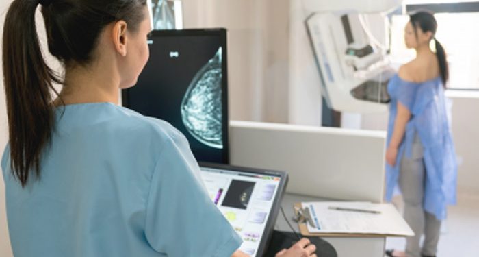 Mamografías pueden dar claves sobre el riesgo de enfermedad cardiovascular