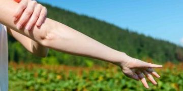 Ministerio de Salud recomienda medidas para proteger la piel en el verano