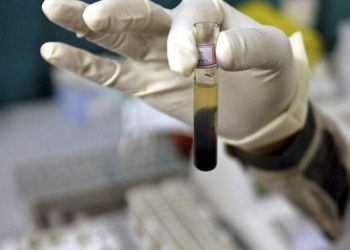 Investigan origen de hepatitis aguda