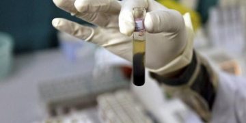 Investigan origen de hepatitis aguda