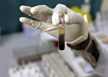 Brasil monitorea 28 casos sospechosos de hepatitis infantil aguda