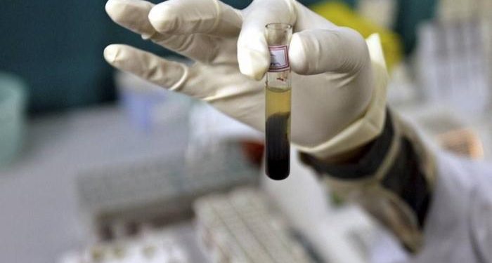 Brasil monitorea 28 casos sospechosos de hepatitis infantil aguda