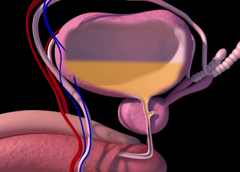 Conozca algunos de los síntomas que alertan problemas de próstata