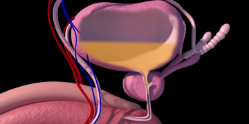 Conozca algunos de los síntomas que alertan problemas de próstata