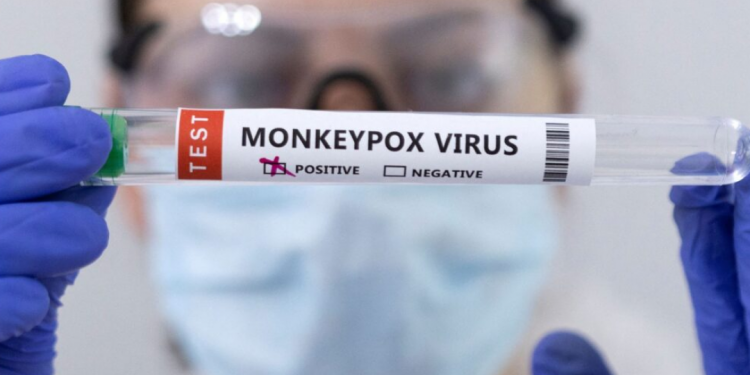 Un estudio identifica nuevos síntomas clínicos de la viruela el mono