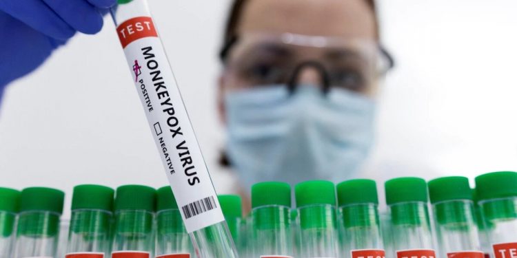 Dan de alta al primer paciente recuperado de viruela del mono en Bolivia