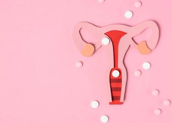 Conozca el síndrome de ovario poliquístico