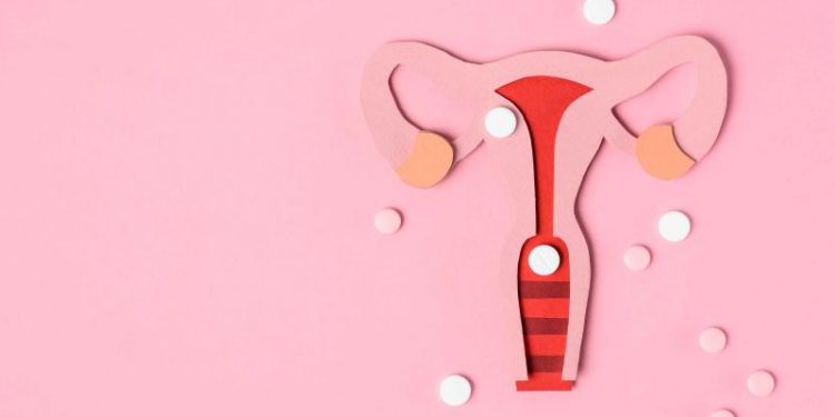Conozca el síndrome de ovario poliquístico