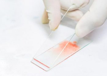 Impulsan un proyecto para optimizar el diagnóstico de enfermedad de Chagas en Suramérica