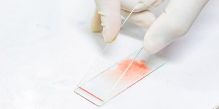 Impulsan un proyecto para optimizar el diagnóstico de enfermedad de Chagas en Suramérica