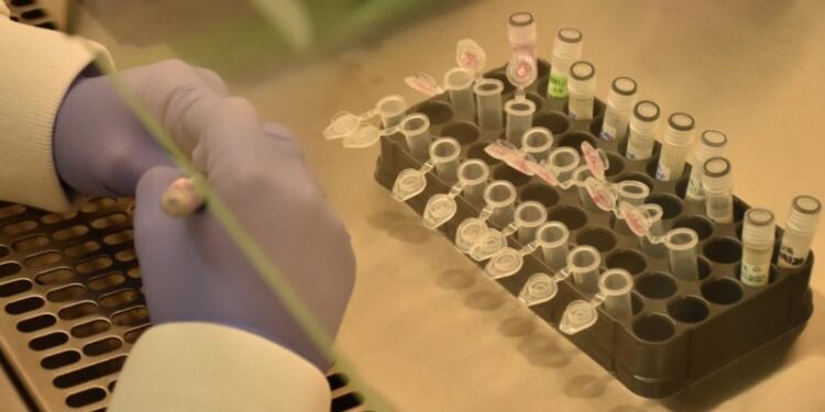 Salud mantiene medidas de prevención por registrarse 10 casos de viruela símica