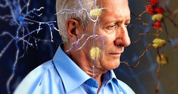 Expertos de Iberoamérica unen fuerzas para crear la Universidad de Alzhéimer