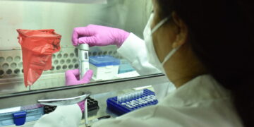 Reportan 17 casos recuperados de viruela símica en el país