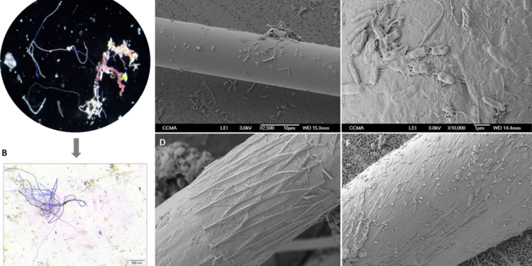 Microfibras del Mediterráneo son el hogar de cientos de bacterias