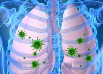 Emiten recomendaciones para evitar la neumonía