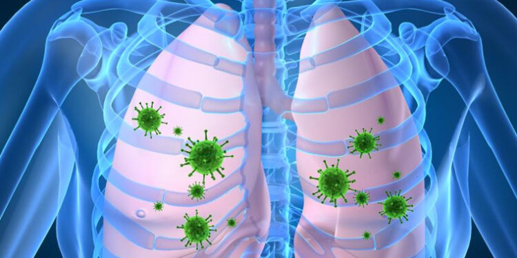 Emiten recomendaciones para evitar la neumonía