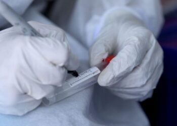 OMS espera en 2023 reducción significativa de COVID-19 y viruela símica