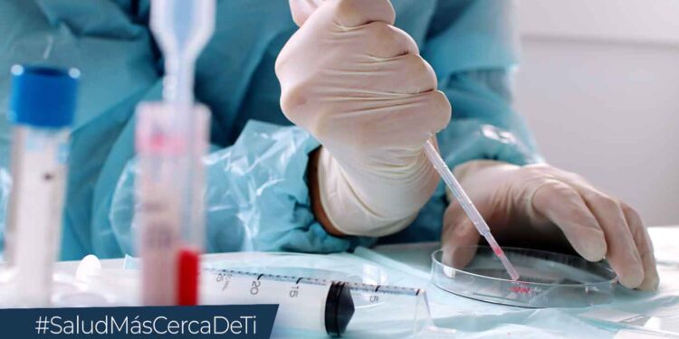 Aumentan los pacientes recuperados de viruela símica en Guatemala