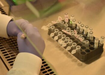 Salud confirma 341 pacientes recuperados de viruela símica