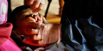 Chiquimula reporta recuperación de niños afectados por la desnutrición