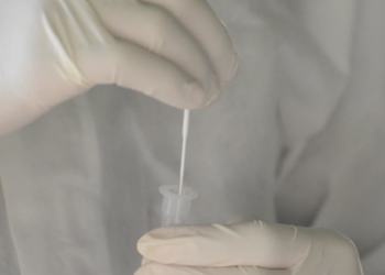 Covid-19: Variante XBB de ómicron es la más frecuente en el país