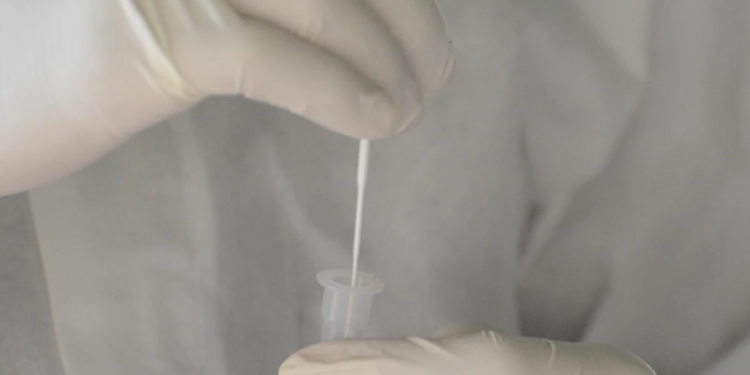 Covid-19: Variante XBB de ómicron es la más frecuente en el país