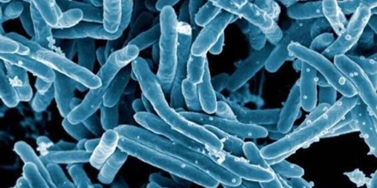 OMS refuerza lucha contra tuberculosis para su erradicación en 2030