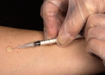 Salud promueve detección y tratamiento oportuno de la tuberculosis en Retalhuleu