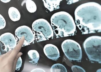 Un fármaco puede retrasar primeros síntomas de esclerosis múltiple