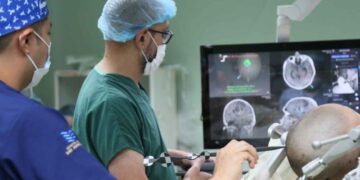 Utilizan con éxito neuronavegador en biopsia cerebral