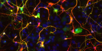 Astrocitos serían la clave en la balanza del Alzheimer.