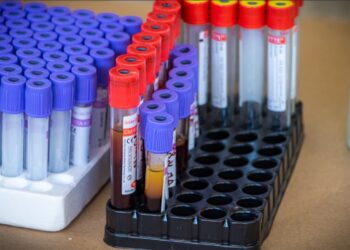 La jornada de donación de sangre ayudará a salvar vidas.